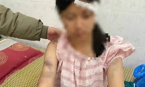 Bà nội cùng hai người đàn ông tra khảo, đánh đập cháu gái 13 tuổi dã man - Lý do gây phẫn nộ