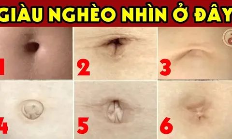 Nhìn tướng rốn 3 giây biết tương lai giàu sang hay nghèo khổ