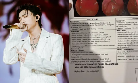 SOOBIN gửi kết quả khám cho fan: bị phù nề, sung huyết mũi họng hậu concert