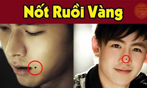 6 nốt ruồi may mắn hút tiền tài vào nhà