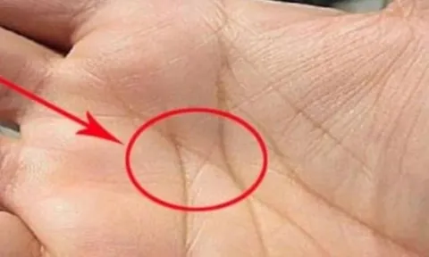 Người giàu sang dễ nhận biết: 3 dấu hiệu trên bàn tay tiết lộ tài lộc theo nhân tướng học