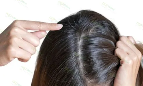 Mẹo chăm sóc tóc bạc cho phụ nữ trung niên tránh khô xơ, ngả vàng