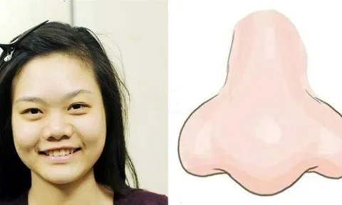 Phụ nữ có 3 nét tướng xấu này, nhưng lại vượng phu ích tử, phú quý cả đời