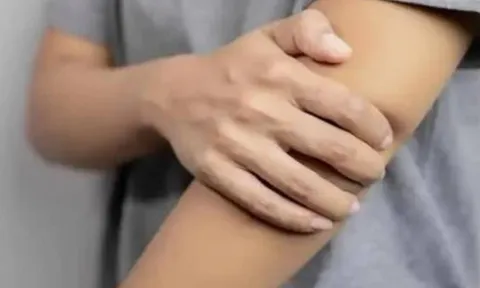 Cảnh báo ung thư: 4 dấu hiệu ở cánh tay tuyệt đối không được bỏ qua – Phát hiện sớm cứu sống bạn