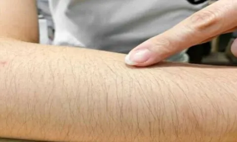 Nơi nào càng mọc nhiều lông càng có lợi cho sức khỏe? Tại sao nhiều người vẫn tẩy sạch, đặc biệt là phái nữ?