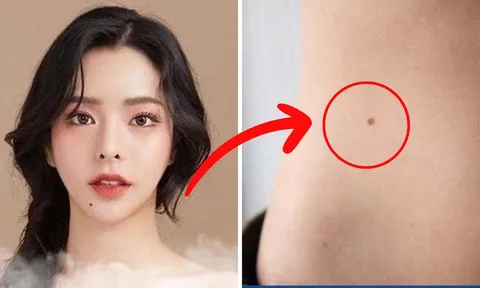 Phụ nữ có 3 nốt ruồi ở vị trí hiếm này: Số mệnh phú quý, viên mãn, tình tiền sáng rực rỡ