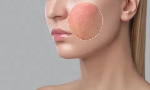 Cách xác định loại da của bản thân