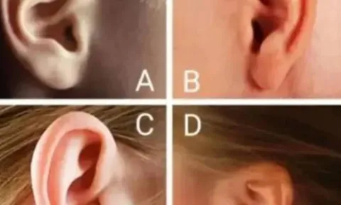 Trắc nghiệm tâm lý: Chọn hình dáng tai giống bạn nhất để biết bạn có giàu sang, may mắn?