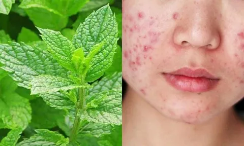 5 mẹo làm đẹp da và tóc với bạc hà