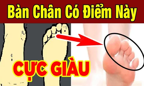 Tướng bàn chân giàu có 3 đời