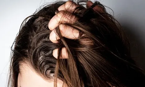3 thói quen khiến nay gội mai tóc đã bết dầu