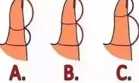 Quiz: Ngón tay cái tiết lộ tính cách và sức khỏe khi bạn về già, cực chính xác!