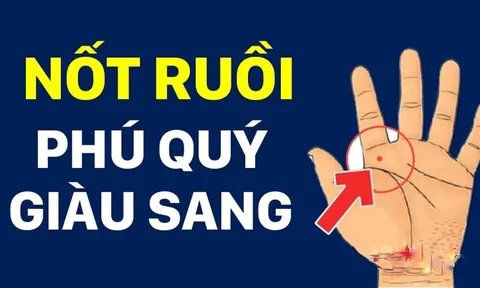 5 nốt ruồi trên tay Ăn May Cả Đời, có 1/5 cũng sướng