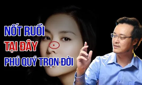 3 nốt ruồi chủ nhân chuyển vận giàu có