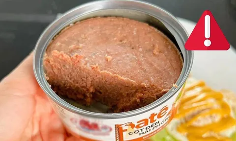 Người ăn phải pate chế biến từ thịt lợn bệnh, có nguy cơ gặp phải 3 vấn đề sức khỏe nghiêm trọng