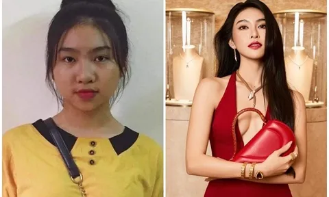 Lộ ảnh hot girl Linh Trương trước khi phẫu thuật thẩm mỹ, gây tranh cãi mạng xã hội