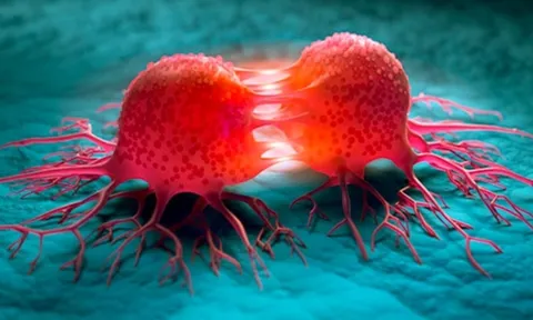 3 dấu hiệu vào buổi tối của người dễ mắc ung thư