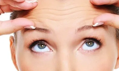 Nếp nhăn vùng trán: Dấu hiệu lão hóa sớm và cách khắc phục