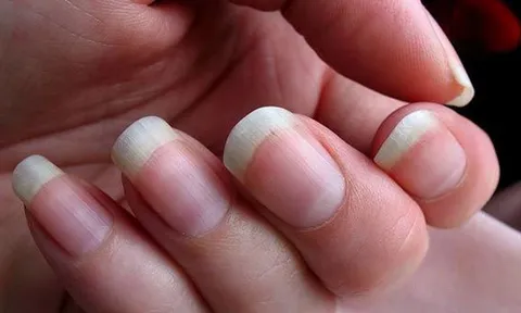 Tận dụng nước vo gạo để giúp móng tay chắc khỏe và bớt giòn gãy