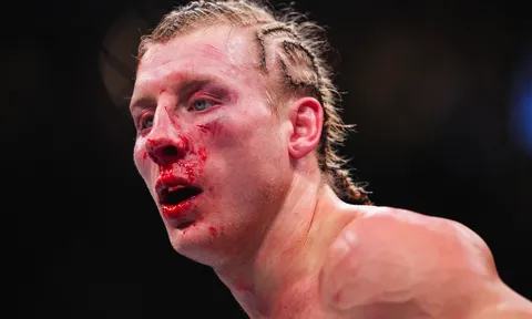 Paddy Pimblett và bài học xương máu từ Justin Gaethje: "Anh ta đã thay đổi hoàn toàn bộ mặt của tôi"