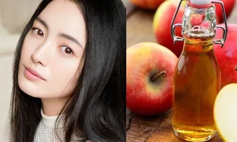 Giấm táo và những lợi ích bất ngờ giúp phục hồi da đầu, nuôi dưỡng mái tóc khỏe từ gốc