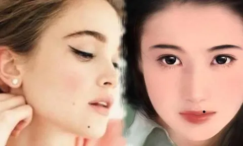 4 nốt ruồi may mắn: Ai có được đừng dại xóa đi