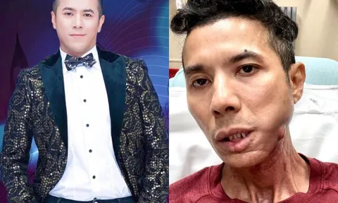 Kasim Hoàng Vũ: Sự nghiệp đang ở đỉnh cao thì định cư Mỹ, cuối đời ngoại hình khác lạ vì cắt toàn bộ xương hàm