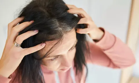 Tóc bạc nhiều hay ít có liên quan đến tuổi thọ? Bác sĩ nói ra sự thật khiến nhiều người bất ngờ