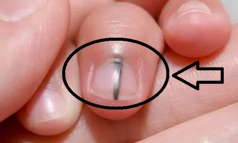 3 chỗ trên người chuyển màu đen báo tuổi thọ ngắn, số 1 nguy hiểm nhất