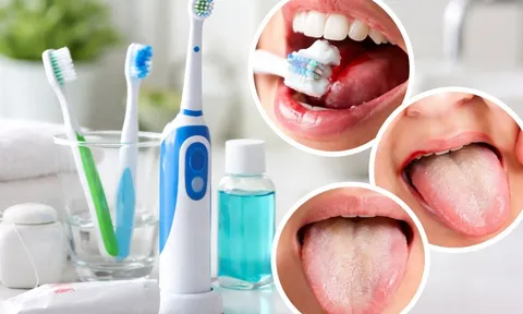 5 dấu hiệu khi đánh răng có thể cảnh báo cơ thể đang gặp vấn đề nguy hiểm, đừng chủ quan