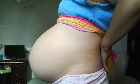 Cô gái trẻ bụng phình to như cái trống dù không hề mang bầu, kết quả chụp CT khiến ê-kíp bác sĩ tái mặt