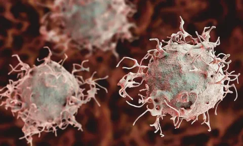 5 biểu hiện vào buổi sáng của người dễ bị ung thư