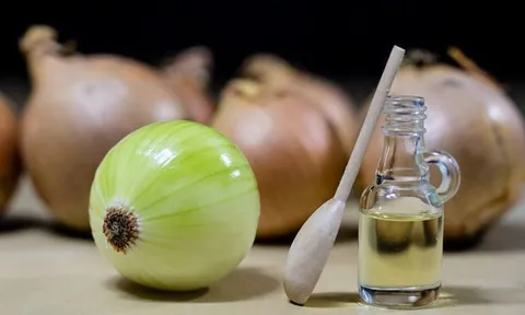 Nước ép hành tây có thực sự giúp kích thích mọc tóc?
