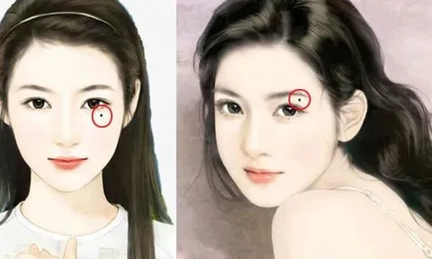 4 nốt ruồi lận đận tình duyên, cản trở tài lộc