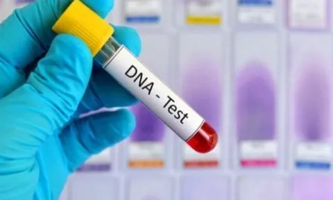 Người phụ nữ mang mẫu của 7 người đàn ông khác nhau đi xét nghiệm ADN để tìm cha ruột cho con