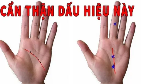 Bàn tay có 4 nét tướng này dù tài ba tới mấy cũng khó thoát nghèo