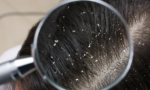 3 Bước chăm sóc tóc giúp da đầu khỏe và tóc mềm mượt hơn