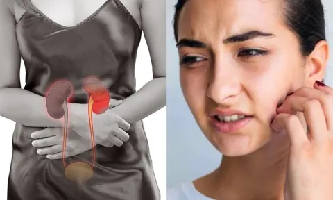 5 dấu hiệu trên mặt cảnh báo suy thận đang âm thầm xảy ra