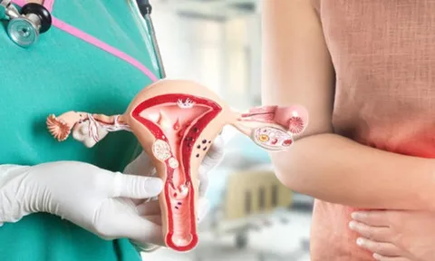 5 dấu hiệu ung thư cổ tử cung dễ nhận biết nhất: Đặc biệt dấu hiệu số 2