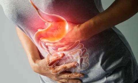 Loại vi khuẩn 'ẩn mình' trong dạ dày: Bác sĩ cảnh báo nguy cơ ung thư, 4 nhóm người cần đi kiểm tra ngay