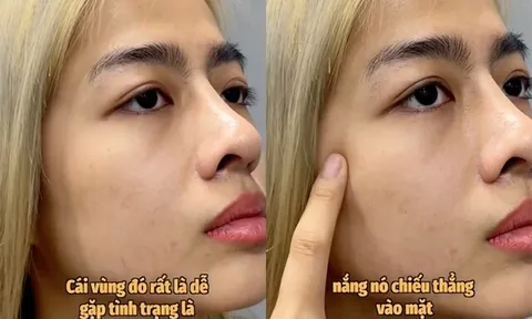 Tuyệt chiêu bôi kem chống nắng “2 lớp” của KOC Quỳnh Như Nguyễn: Tại sao vùng gò má cần được bảo vệ gấp đôi?