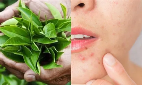 Trà xanh và làn da: lợi ích nổi bật cùng cách sử dụng đúng để hỗ trợ chống lão hóa