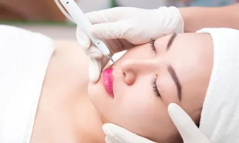 Chăm sóc da sau khi tẩy nốt ruồi: 5 nguyên tắc giúp da hồi phục nhanh, hạn chế thâm sẹo