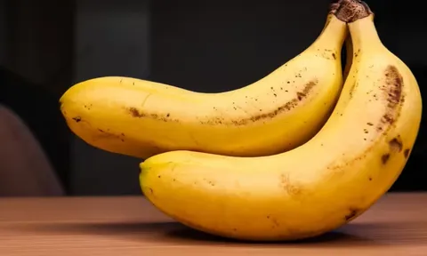 Người mắc 4 bệnh này nên hạn chế ăn chuối