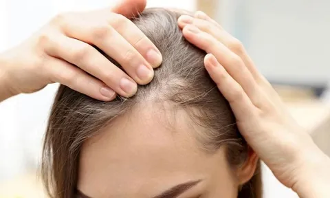 3 yếu tố cốt lõi giúp cải thiện tóc thưa, yếu mà không cần phụ thuộc sản phẩm đắt tiền