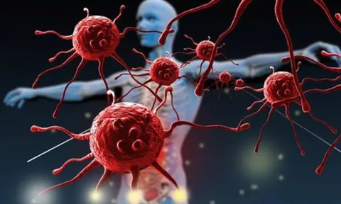 5 loại ung thư dễ di truyền nhất