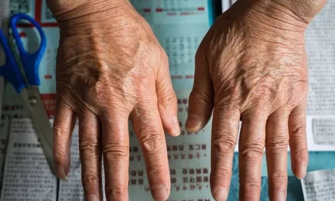 Bàn tay người sống thọ có đặc điểm gì? Nghiên cứu 2 triệu người chứng minh sự thật bất ngờ