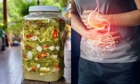 5 thực phẩm càng ăn nhiều càng dễ bị ung thư dạ dày