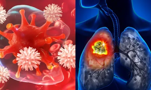 5 loại ung thư phổ biến và nguy hiểm nhất