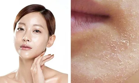 6 dấu hiệu khiến gương mặt trông già hơn tuổi và cách cải thiện hiệu quả